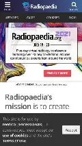 Frame #7 - radiopaedia.org