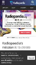 Frame #8 - radiopaedia.org